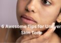 6 Awesome Tips for Uneven Skin Tone